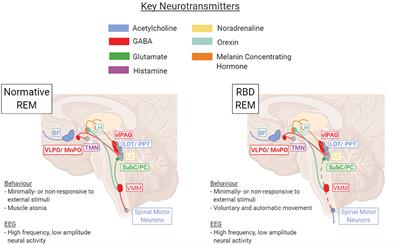 Frontiers A Neurologist s Guide to REM Sleep Behavior Disorder